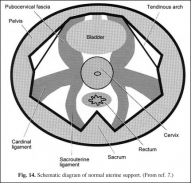 Schematic diagram of normal uterine support